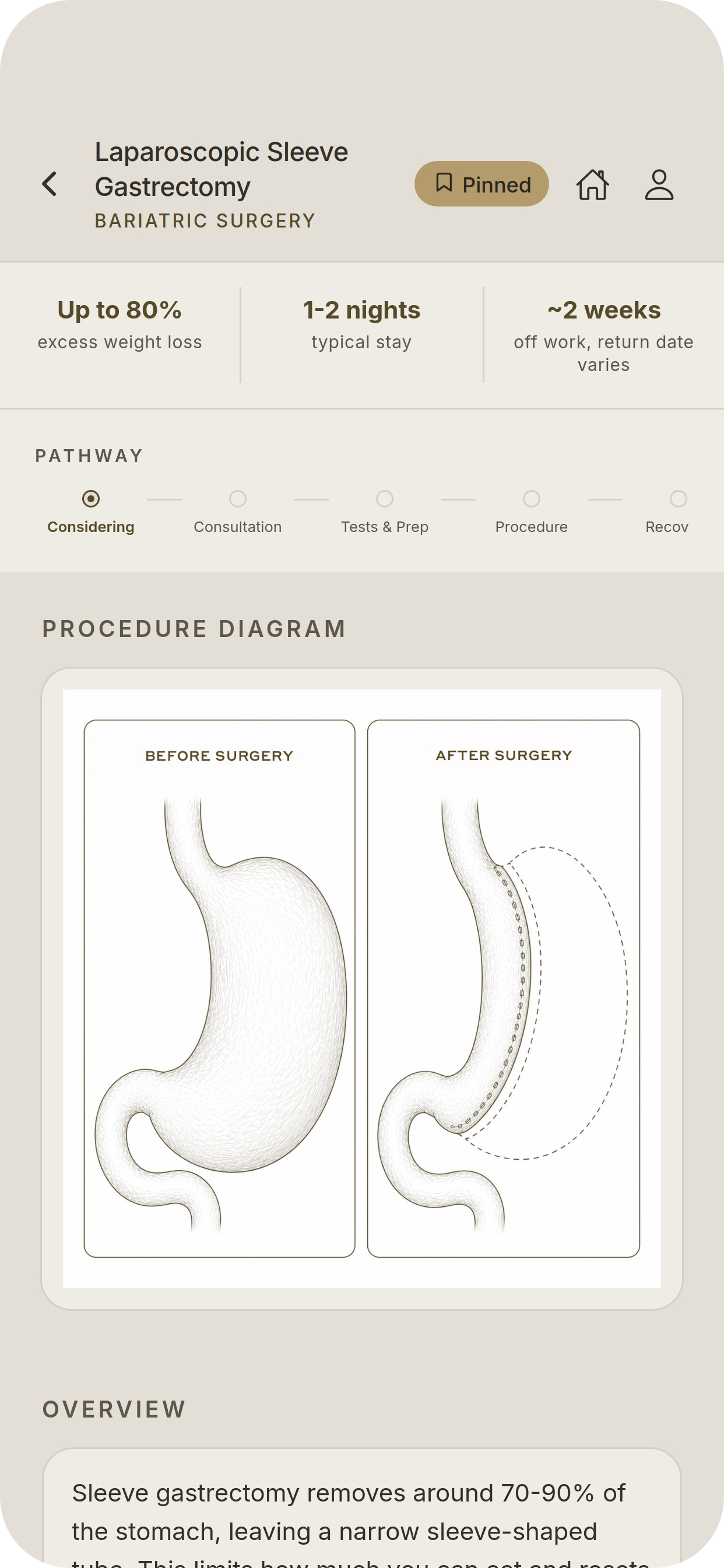 Treatment information screen showing Laparoscopic Sleeve Gastrectomy with procedure diagram